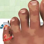 Stopa z zaniedbanymi paznokciami i otarciami na palcach, z wbitymi gwoździami w mały palec